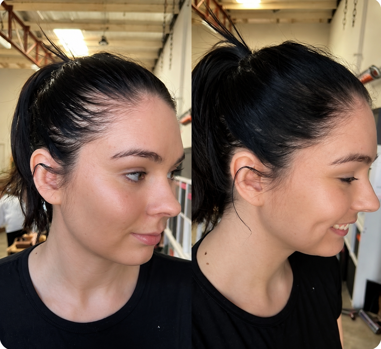Woman before and after using AMELINA — thinning crown to full healthy hair